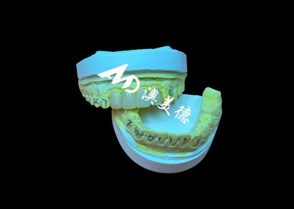 Dental Restoration Translucent Zirconia Dental Crown For Precise Fit And Natural