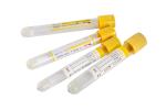 Medical Grade Vacuum Blood Test Tube for Safe and Blood Collection