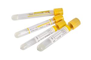Wholesale PET Glass Yellow Gel Clot Activator Tube 9ml Serum Separator Tube from china suppliers