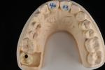 Professional Grade Dental Zirconia Hybrid Imitation Material Smooth Or Rough