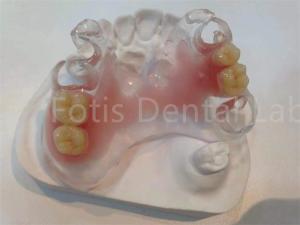 Wholesale Hypoallergenic Stain Resistant TCS Valplast Dental Prosthetics For Long Lasting Comfort from china suppliers
