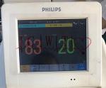 Medical PHiliph FM20 Fetal Portable Used Patient Monitor Repair / Parts