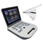 Xianfeng Digital Portable Ultrasound Scanner OEM OEM