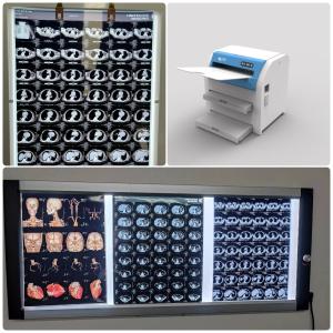 Wholesale 11x14 14x17 Medical Dry Fuji Film With Maximum Transmission Density ≥3.0 D from china suppliers