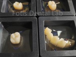 Wholesale Dental Restorations Zirconia Multilayer Fracture Resistance from china suppliers
