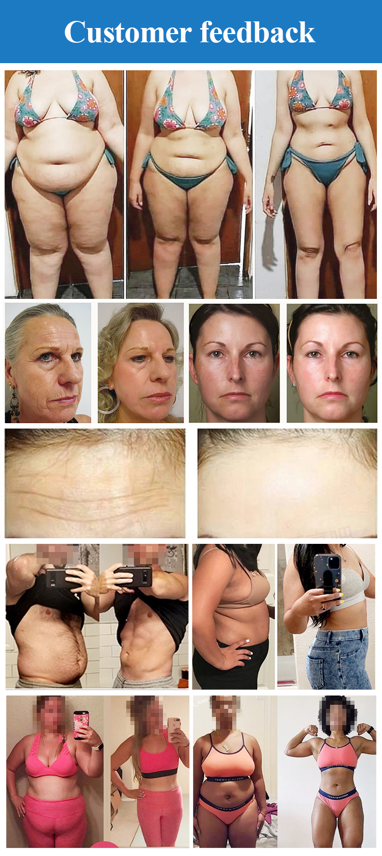 Vacuum Anti Cellulite RF Weight Loss Equipment Slimming Machine Weight Loss