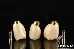Wholesale High Durability White Finish Implant Crown And Bridge With Accurate Fit from china suppliers