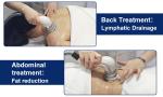 448khz Indiba Vacuum Radiofrecuencia Facial Y Corporal Body Slimming Machine