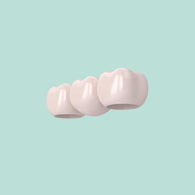 Beautiful Dental Crowns And Bridges Smooth Surface For Oral Hygiene Safety