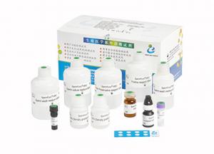 Wholesale Induced Sperm Acrosome Reaction Reagent Kit Accuracy Male Fertility Test Kit from china suppliers
