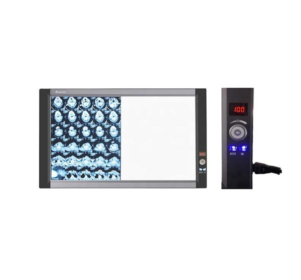 Hot Sale Manufacturer Supply LED Medical X-ray Film Viewer