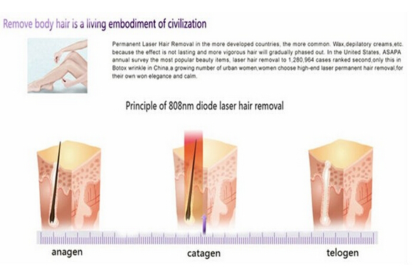 diode laser hair removal.jpg