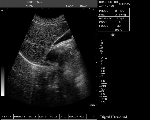 Human Digital Ultrasound Machines Black And White BB BM 12.1in LED Screen 10