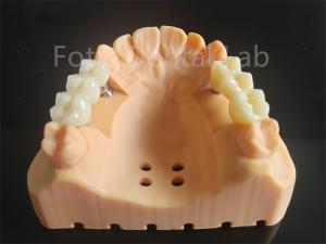 Wholesale Customized Full Contour Zirconia Layered With Porcelain Dental Material from china suppliers