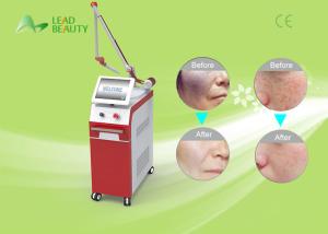 Wholesale professional Q-Switch ND YAG laser tattoo removal machine with high power from china suppliers
