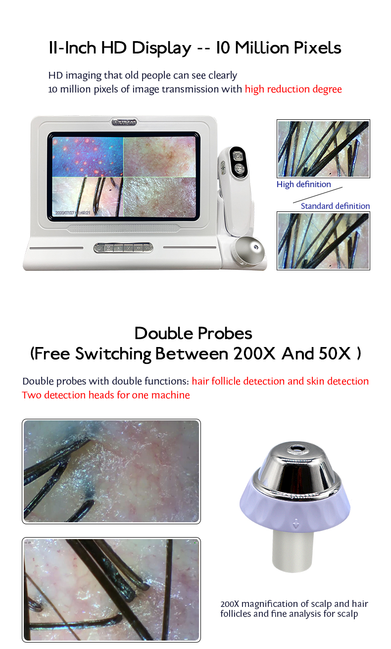 Professional 11 Inch Touch Screen Hair Analysis Machine for Salon and Beauty Center