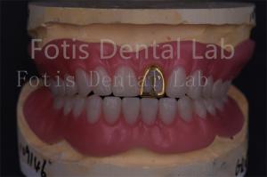 Wholesale Professional Technicians Acrylic Complete Denture Fake Teeth Prosthetics Precision Fit from china suppliers