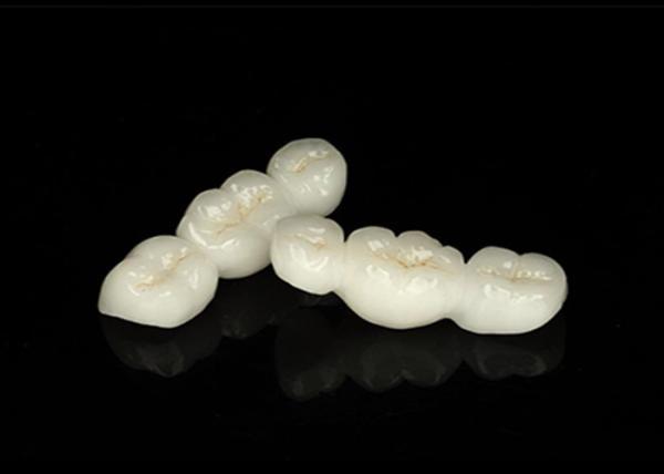 Translucent Natural Looking Zirconia dental Crown with Excellent Durability and