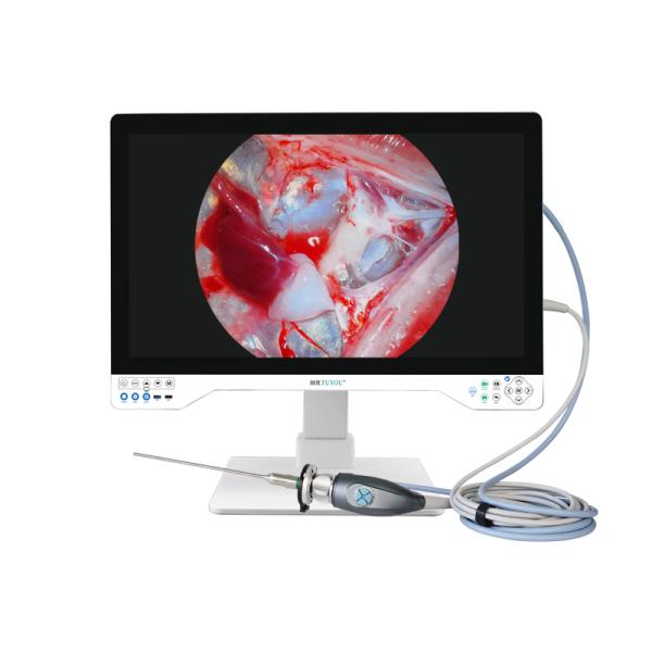 Professional Manufacturer 4K 32" Endoscopy Camera With Integrated Light Source For Laparoscopic System