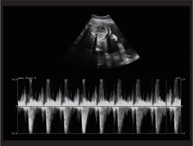 Fetal Doppler Medical Ultrasound Machine Trolley 3D 4D 5D