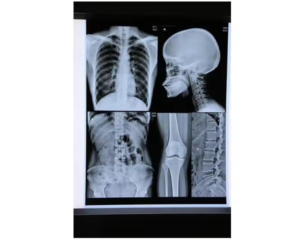 Blue Inkjet Medical X Ray Film Medical Dry Film A4 Sheet Or In Roll No Reviews