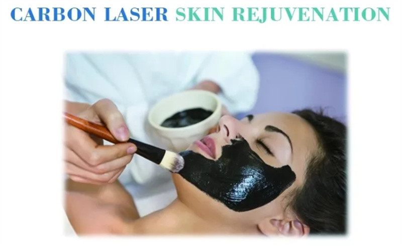 Hot Sales Portable Nd Yag Laser Tattoo Removal Carbon Laser Peel Machine