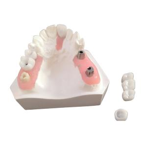 Wholesale Good Biological Inter Miscibility Dental Implant Bar With FDA Approval from china suppliers