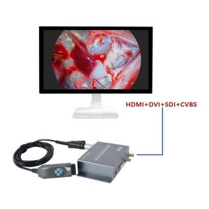 Wholesale Manufacture TUYOU Integrated Portable 1080P Medical Imaging Endoscopy Camera For Ent Nasal And Pet Surgery from china suppliers