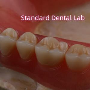 Wholesale SDL Heat Cured Acrylic Partial Denture Ivoclar Teeth Dental Lab High Accuracy from china suppliers