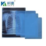 Blue Film Inkjet X Ray Printing 8''*10'' Sheet PET Inkjet Blue Film Medical Dry