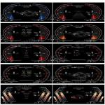 VIKNAV Car Digital Instrument Cluster For BMW 5-7Series GT F01-F04F10-F13 X3-X6