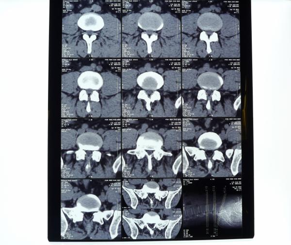 Transparency Digital X Ray Film , Medical Imaging AGFA / Fuji X Ray Dry Film