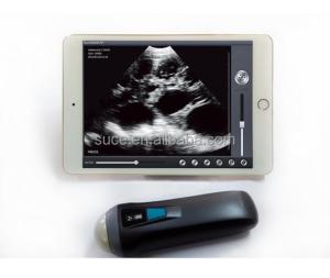 Wholesale Laptop color Doppler ultrasound system Uprobe-1 from china suppliers