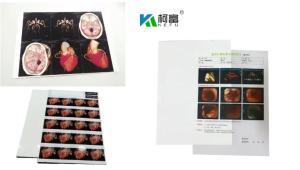 Wholesale 204±8 μM Thickness Medical Dry Film With High Durability ≤20% Haze UV Resistance from china suppliers