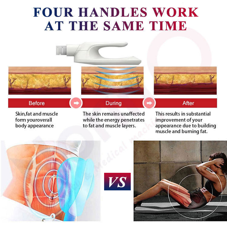 5000W Neo RF Body Sculpting Machine HIEMT Muscle Building