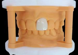 Wholesale Translucency Zirconia Dental Crown with Aesthetic Performance from China Dental Lab from china suppliers