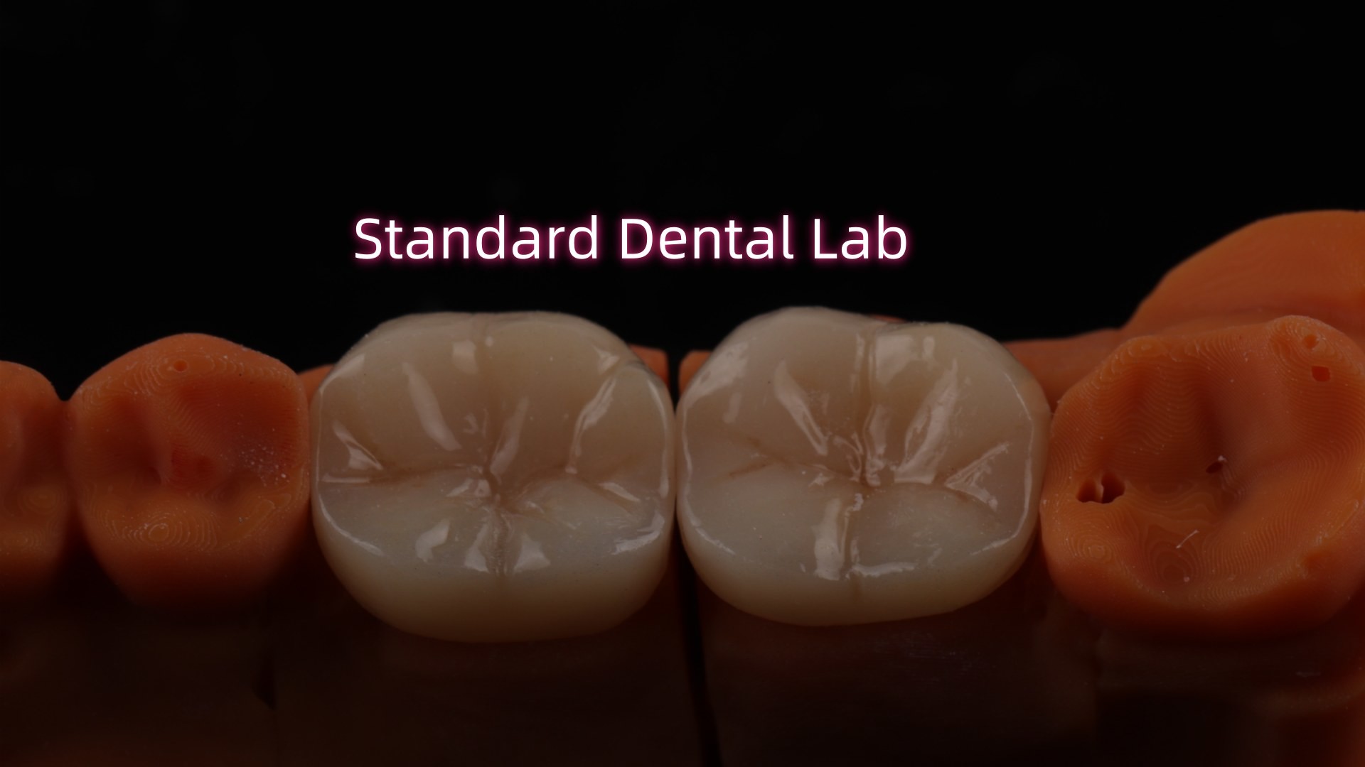 Full Contour Zirconia Crown Translucency 3D PRO No Porcelian Overlay Standard Dental Lab
