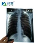 8x10 Inch 14x17 Inch Blue Medical X Ray Film Substitute Fuji Medical Dry Film
