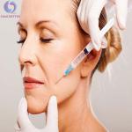 Laugh Lines Collagen Natural Dermal Filler Hyaluronic Acid Lip Injections