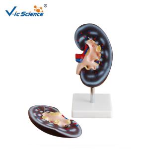Wholesale Medical Human Anatomical Model Plastic Kidney Anatomy Model 2 Parts VIC-310-2 from china suppliers