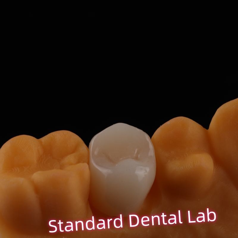 Full Contour Zirconia Crown Exceptional Strength and Esthetics No Porcelian Overlay Posterior Crown China Dental Lab