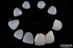 Customization Porcelain Material Emax Teeth Veneers For High Aesthetics Bonding