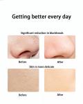 Ultrasonic Cleaning Lifting Skin care Machine Spatula Positive Negative Ions