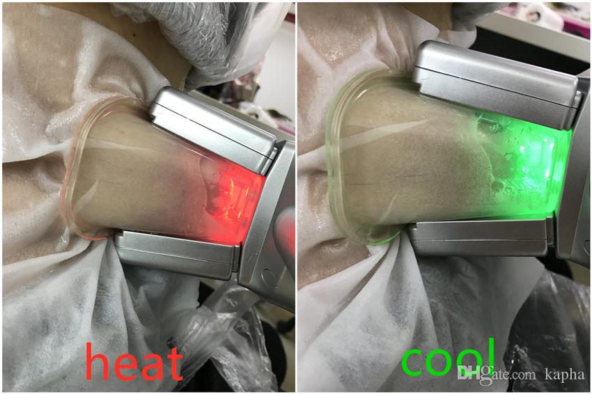 350W 4 Hadles Home Cryolipolysis Fat Freezing Machine