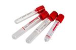 Pain Red Top Blood Tube No Additive Blood Collection Tubes Bd No Additive Tube