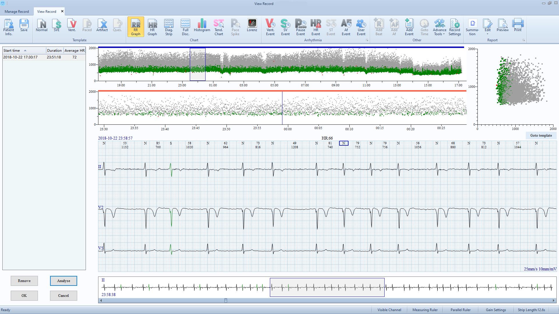 EDAN SE-2012 ECG 3 Channel 12 channel Holter Up to 8 days cable heart rate monitor