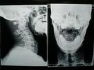 Wholesale Konida Medical Dry Imaging Film Digital X-ray For Fuji / Agfa Printers from china suppliers