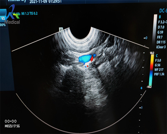 Mindary DE10-3E Ultrasound Probe Repair Connecting Cable