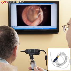 Wholesale 5mm 1080p 60fps Otoscope Ear Camera Endoscope Endoscopy Camera Module from china suppliers