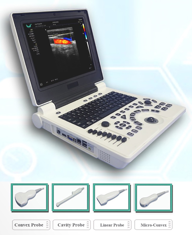 Best Cheap Price Medical Ultrasound Diagnostic System Laptop Portable Color Doppler Ultrasound Machine for Hospital